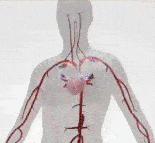 gif-2-1.gif